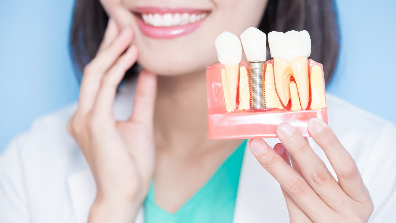 علاج زراعة الأسنان